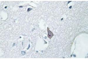 Image no. 2 for anti-Opioid Receptor, mu 1 (OPRM1) antibody (ABIN317766) (Mu Opioid Receptor 1 antibody)
