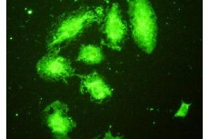 Detection of TLR5 in A549 cells using Polyclonal Antibody to Toll Like Receptor 5 (TLR5) (TLR5 antibody  (AA 46-205))