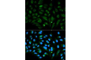 Immunofluorescence analysis of MCF-7 cells using DCN antibody (ABIN5970829). (Decorin antibody)