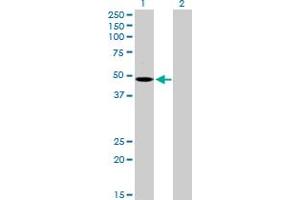 Western Blot analysis of MCHR1 expression in transfected 293T cell line by MCHR1 MaxPab polyclonal antibody. (MCHR1 antibody  (AA 1-422))