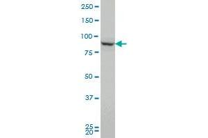 PCSK1 monoclonal antibody (M02), clone 3D2 Western Blot analysis of PCSK1 expression in HeLa .