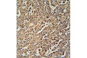 Formalin fixed and paraffin embedded human spleen tissue reacted with ENASE Antibody  followed by peroxidase conjugation of the secondary antibody and DAB staining. (ENGASE antibody  (Middle Region))