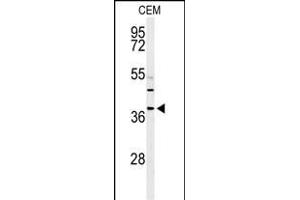 Western blot analysis of RNASEH2B Antibody (Center) (ABIN650970 and ABIN2840016) in CEM cell line lysates (35 μg/lane). (RNASEH2B antibody  (AA 130-157))