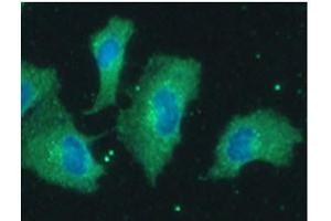 ICC/IF analysis of PPP1R14A in A549 cells line, stained with DAPI (Blue) for nucleus staining and monoclonal anti-human PPP1R14A antibody (1:100) with goat anti-mouse IgG-Alexa fluor 488 conjugate (Green). (CPI-17 antibody)