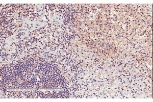 ABIN571017 (2µg/ml) staining of paraffin embedded Human Lymph Node. (ITGAL antibody  (Internal Region))
