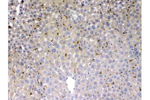 PSAT1 was detected in paraffin-embedded sections of mouse liver tissues using rabbit anti- PSAT1 Antigen Affinity purified polyclonal antibody (Catalog # ) at 1 ? (PSAT1 antibody  (AA 276-370))