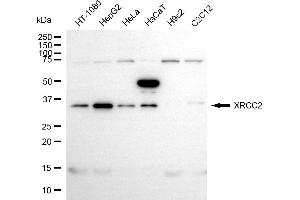 anti-X-Ray Repair Complementing Defective Repair in Chinese Hamster Cells 2 (XRCC2) antibody