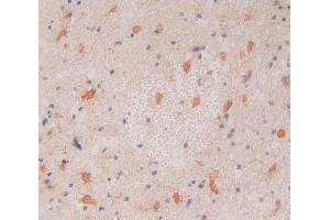 Used in DAB staining on fromalin fixed paraffin- embedded glioma tissue (CNTNAP4 antibody  (AA 706-886))