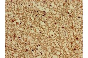 Immunohistochemistry of paraffin-embedded human brain tissue using ABIN7154707 at dilution of 1:100 (GNAS antibody  (AA 1-394))