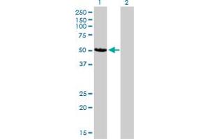 Western Blot analysis of CAMK2D expression in transfected 293T cell line by CAMK2D monoclonal antibody (M02), clone 1A8. (CAMK2D antibody  (AA 301-410))