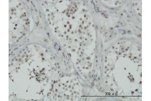 Immunoperoxidase of monoclonal antibody to C15orf15 on formalin-fixed paraffin-embedded human testis.