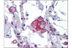 Human Lung: Formalin-Fixed, Paraffin-Embedded (FFPE) (TRPV2 antibody  (Ser157))