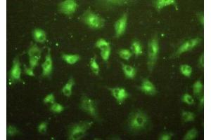 Detection of MPP2 in A549 cells using Polyclonal Antibody to Membrane Protein, Palmitoylated 2 (MPP2) (MPP2 antibody  (AA 3-214))