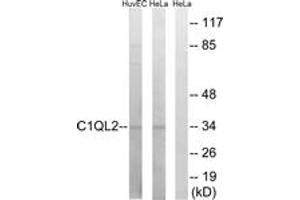 Western Blotting (WB) image for anti-Complement Component 1, Q Subcomponent-Like 2 (C1QL2) (AA 231-280) antibody (ABIN2890232) (C1QL2 antibody  (AA 231-280))