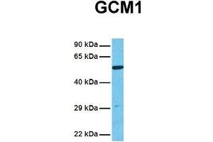 Host:  Rabbit  Target Name:  GCM1  Sample Tissue:  Human 293T  Antibody Dilution:  1. (GCM1 antibody  (N-Term))