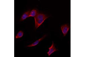 ABIN6264846 and ABIN6273312 staining Hela by IF/ICC.