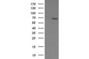 Image no. 2 for anti-Estrogen Receptor 1 (ESR1) antibody (ABIN1498061) (Estrogen Receptor alpha antibody)