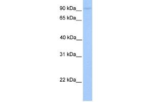 WB Suggested Anti-AGBL5 Antibody Titration: 0. (AGBL5 antibody  (C-Term))