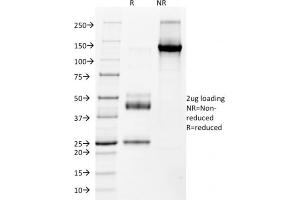 SDS-PAGE Analysis Purified NKX2. (Nkx2-2 antibody  (AA 1-119))