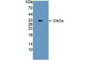 Detection of Recombinant CASP11, Human using Polyclonal Antibody to Protein SCAF11 (SCAF11) (SCAF11 antibody  (AA 944-1148))