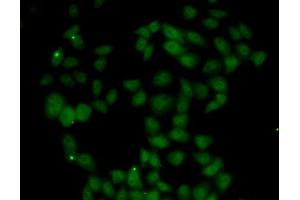 Immunofluorescence analysis of U2OS cells using FGF14 antibody (ABIN5973959). (FGF14 antibody)