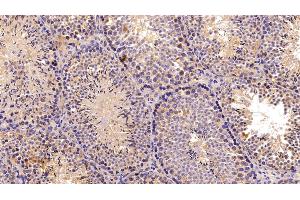 Detection of C3 Convertase in Mouse Testis Tissue using Polyclonal Antibody to Complement C3 Convertase (C3 Convertase) (Complement C3 Convertase antibody)