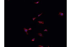 ABIN6268891 staining LOVO cells by IF/ICC. (FAP antibody  (Internal Region))