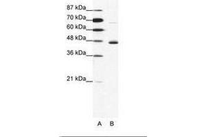 Image no. 1 for anti-Neuronal Differentiation 1 (NEUROD1) (N-Term) antibody (ABIN202333) (NEUROD1 antibody  (N-Term))