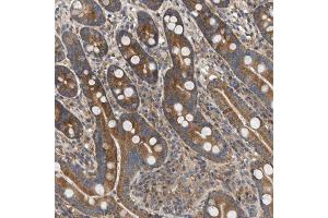 Immunohistochemical staining (Formalin-fixed paraffin-embedded sections) of human duodenum shows cytoplasmic positivity in glandular cells. (PPM1B antibody  (AA 359-463))