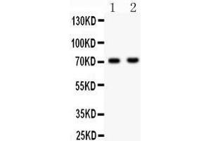 Anti- NUMB Picoband antibody, Western blotting All lanes: Anti NUMB  at 0. (NUMB antibody  (N-Term))