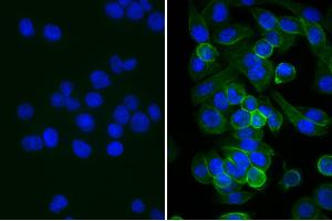 Human pancreatic carcinoma cell line MIA PaCa-2 was stained with Mouse Anti-Human CD44-UNLB, and DAPI. (Rabbit anti-Mouse IgG (Heavy & Light Chain) Antibody)