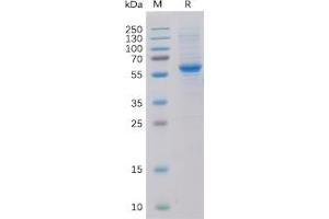 Human ROR2 Protein, His Tag on SDS-PAGE under reducing condition. (ROR2 Protein (His tag))
