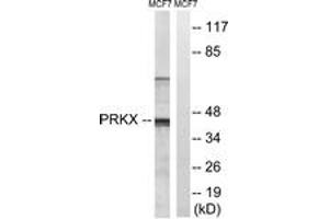 Western blot analysis of extracts from MCF-7 cells, using PRKX Antibody. (PRKX antibody  (AA 251-300))
