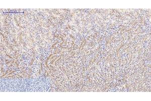 Immunohistochemistry of paraffin-embedded Mouse kidney tissue using Catenin beta Monoclonal Antibody at dilution of 1:200. (beta Catenin antibody)