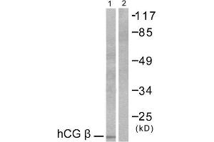Western Blotting (WB) image for anti-HCG beta (C-Term) antibody (ABIN1848592) (HCG beta antibody  (C-Term))