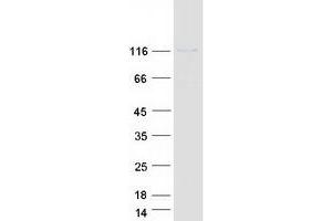Western Blotting (WB) image for phosphorylase Kinase, alpha 1 (Muscle) (PHKA1) (Transcript Variant 1) protein (Myc-DYKDDDDK Tag) (ABIN2728838)