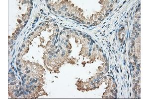 Immunohistochemical staining of paraffin-embedded Human prostate tissue using anti-PRKAR2A mouse monoclonal antibody. (PRKAR2A antibody)