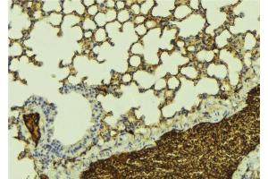 ABIN6277156 at 1/100 staining Mouse lung tissue by IHC-P. (KCNQ1 antibody  (C-Term))