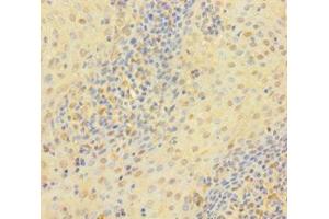 Immunohistochemistry of paraffin-embedded human tonsil tissue using ABIN7172118 at dilution of 1:100 (Thymidine Phosphorylase antibody  (AA 13-254))