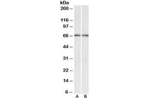 Western blot testing of human A) cerebellum and B) hippocampus lysate with Acetylcholinesterase antibody at 0. (Acetylcholinesterase antibody)