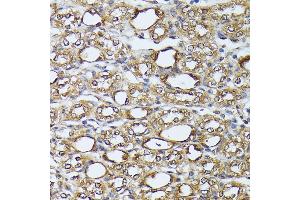 Immunohistochemistry of paraffin-embedded mouse kidney using D antibody (ABIN7266712) at dilution of 1:100 (40x lens). (DAPK3 antibody  (AA 1-100))