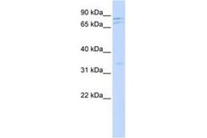 Image no. 1 for anti-NIMA (Never In Mitosis Gene A)-Related Kinase 11 (NEK11) (AA 504-553) antibody (ABIN6743500) (NEK11 antibody  (AA 504-553))