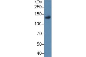 Detection of LIFR in Rat Placenta lysate using Polyclonal Antibody to Leukemia Inhibitory Factor Receptor (LIFR) (LIFR antibody  (AA 642-791))