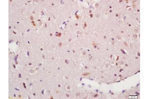 Formalin-fixed and paraffin embedded rat brain labeled with Anti-phospho-MAPKAPK5(Thr182) Polyclonal Antibody, Unconjugated (ABIN710546) at 1:200, followed by conjugation to the secondary antibody and DAB staining (MAPKAP Kinase 5 antibody  (pThr182))