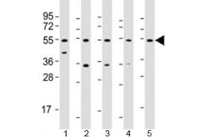 Western blot testing of human 1) liver, 2) HeLa, 3) PC-3, 4) SK-BR-3 and 5) TT cell lysate with THRB antibody at 1:2000. (THRB antibody  (AA 23-55))
