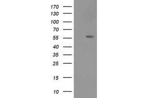 HEK293T cells were transfected with the pCMV6-ENTRY control (Left lane) or pCMV6-ENTRY TP53 (Right lane) cDNA for 48 hrs and lysed. (p53 antibody)