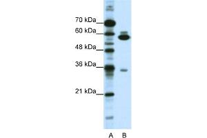 WB Suggested Anti-ZNF446 Antibody Titration:  1. (ZNF446 antibody  (C-Term))