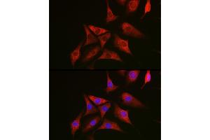 Immunofluorescence (IF) image for anti-GTPase NRas (NRAS) (AA 1-189) antibody (ABIN7267532)