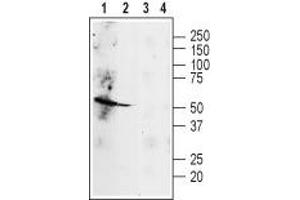 Western blot analysis of rat heart (lanes 1 and 3) and lung (lanes 2 and 4) lysates: - 1,3. (beta 2 Adrenergic Receptor antibody  (Extracellular, N-Term))