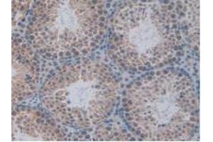 IHC-P analysis of Mouse Testis Tissue, with DAB staining. (TCF20 antibody  (AA 1871-1965))